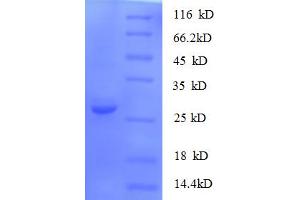 SDS-PAGE (SDS) image for S100 Calcium Binding Protein A11 (S100A11) (AA 2-105) protein (His-SUMO Tag) (ABIN5710294) (S100A11 Protein (AA 2-105) (His-SUMO Tag))