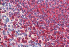 Human Spleen (formalin-fixed, paraffin-embedded) stained with  antibody ABIN462273 followed by biotinylated secondary antibody, alkaline phosphatase-streptavidin and chromogen. (Glucose-6-Phosphate Dehydrogenase Antikörper  (AA 35-506))