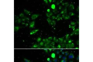 Immunofluorescence analysis of U2OS cells using UQCRFS1 Polyclonal Antibody (UQCRFS1 Antikörper)