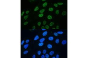 Immunofluorescence analysis of U2OS cells using Phospho-Histone H3-S28 antibody (ABIN7267689) at dilution of 1:100.