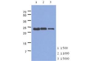 The extracts of mouse muscle (40ug) were resolved by SDS-PAGE, transferred to PVDF membrane and probed with anti-human TNNI1 antibody (1:500 ~ 1:5000). (TNNI1 Antikörper)
