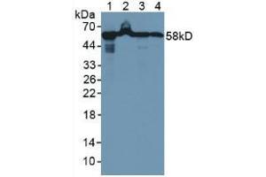 Western blot analysis of (1) Rat Liver Tissue, (2) Rat Pancreas Tissue, (3) Human A549 Cells and (4) Human MCF Cells. (HSPD1 Antikörper  (AA 1-573))
