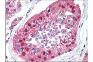 Immunohistochemistry: UBA52 antibody staining of Formalin-Fixed, Paraffin-Embedded Human Testis followed by biotinylated goat anti-rabbit IgG secondary antibody, alkaline phosphatase-streptavidin and chromogen.