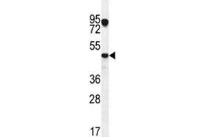 Western Blotting (WB) image for anti-Vascular Endothelial Growth Factor C (VEGFC) (AA 20-49) antibody (ABIN3029579)