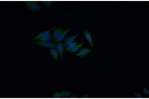 Detection of CD5 in Human HepG2 cell using Polyclonal Antibody to Cluster Of Differentiation 5 (CD5) (CD5 Antikörper  (AA 25-372))