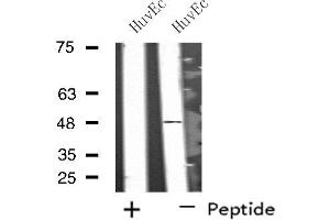 Western blot analysis of extracts from HuvEc cells, using SYT13 antibody. (SYT13 Antikörper  (Internal Region))
