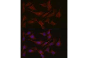 Immunofluorescence (IF) image for anti-Nephronophthisis 1 (Juvenile) (NPHP1) (AA 345-614) antibody (ABIN6144768)