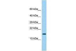 Host: Rabbit Target Name: LY6G6D Sample Type: Fetal Lung lysates Antibody Dilution: 1. (LY6G6D Antikörper  (N-Term))