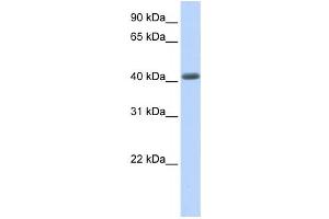 Western Blotting (WB) image for anti-Leucine Rich Repeat Containing 2 (LRRC2) antibody (ABIN2458674)