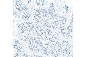 anti-Deleted in Esophageal Cancer 1 (DEC1) (C-Term) antibody