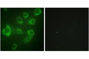 Immunofluorescence analysis of HuvEc cells, using Myosin regulatory light chain 2 (Phospho-Ser18) Antibody. (MYL9 Antikörper  (pSer18))