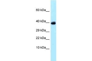 Western Blotting (WB) image for anti-Ubiquitin Specific Peptidase 4 (USP4) (C-Term) antibody (ABIN2789297) (USP4 Antikörper  (C-Term))