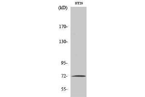 Western Blotting (WB) image for anti-Matrix Metalloproteinase 2 (MMP2) (C-Term) antibody (ABIN3176049) (MMP2 Antikörper  (C-Term))