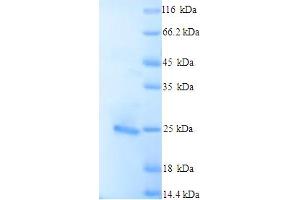 SDS-PAGE (SDS) image for BCL2-Like 11 (Apoptosis Facilitator) (BCL2L11) (AA 1-198), (full length) protein (His tag) (ABIN5713280)