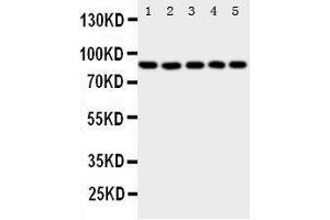 Western Blotting (WB) image for anti-Arachidonate 5-Lipoxygenase (ALOX5) (AA 650-667), (C-Term) antibody (ABIN3044238) (ALOX5 Antikörper  (C-Term))