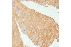 Immunohistochemistry of paraffin-embedded mouse heart using MYBPC3 antibody (ABIN6129601, ABIN6144221, ABIN6144222 and ABIN6215951) at dilution of 1:100 (40x lens). (MYBPC3 Antikörper  (AA 200-400))