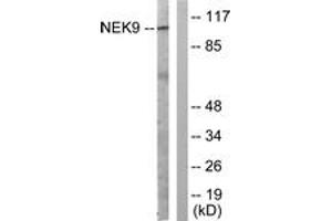 Western blot analysis of extracts from A549 cells, using NEK9 (Ab-210) Antibody.