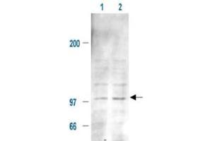 Immunoblotting of Mdm2 (phospho S185) polyclonal antibody  is shown to detect a 102 kDa band (arrow) corresponding to phosphorylated mouse Mdm2 present in a 293T whole cell lysate. (MDM2 Antikörper  (pSer185))