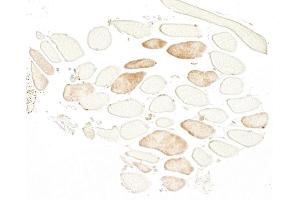 Immunohistochemistry (IHC) image for anti-Troponin I (TNNI) antibody (ABIN7795609) (Troponin I Antikörper)