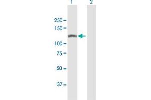 Western Blot analysis of SMARCA5 expression in transfected 293T cell line by SMARCA5 MaxPab polyclonal antibody. (SMARCA5 Antikörper  (AA 1-1052))