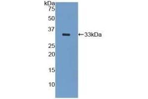 Detection of Recombinant KRT5, Mouse using Polyclonal Antibody to Cytokeratin 5 (CK5) (Cytokeratin 5 Antikörper  (AA 163-471))