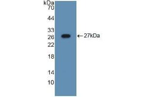 Western blot analysis of recombinant Mouse ASGR1. (Asialoglycoprotein Receptor 1 Antikörper  (AA 80-281))