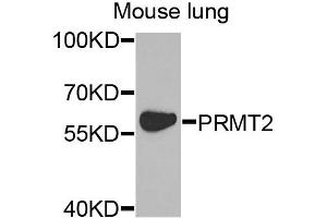 Western blot analysis of extracts of mouse lung, using PRMT2 antibody. (PRMT2 Antikörper)