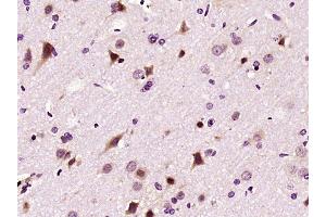 Paraformaldehyde-fixed, paraffin embedded rat brain, Antigen retrieval by boiling in sodium citrate buffer (pH6) for 15min, Block endogenous peroxidase by 3% hydrogen peroxide for 30 minutes, Blocking buffer (normal goat serum) at 37°C for 20min, Antibody incubation with LIMK1 Polyclonal Antibody (bs-2775R) at 1:400 overnight at 4°C, followed by a conjugated secondary and DAB staining. (LIM Domain Kinase 1 Antikörper  (AA 451-550))