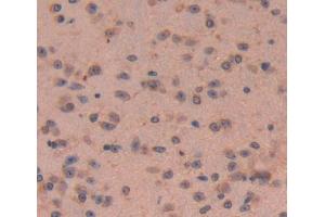 Used in DAB staining on fromalin fixed paraffin- embedded brain tissue (CKAP2 Antikörper)