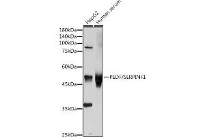 Western blot analysis of extracts of various cell lines, using SERPINF1 antibody (ABIN3022372, ABIN3022373, ABIN3022374, ABIN1513515 and ABIN6218766) at 1:1000 dilution. (PEDF Antikörper  (AA 1-200))