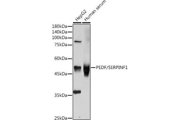 PEDF Antikörper  (AA 1-200)
