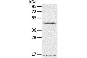 Western blot analysis of K562 cell, using PLTP Polyclonal Antibody at dilution of 1:200