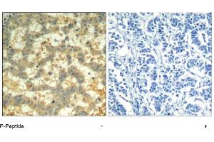 Image no. 1 for anti-Spleen tyrosine Kinase (SYK) (pTyr323) antibody (ABIN319291) (SYK Antikörper  (pTyr323))