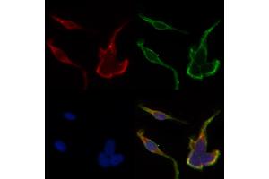 ABIN6262390 and ABIN6268885 staining HepG2 by IF/ICC.