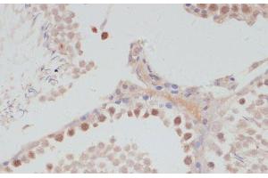 Immunohistochemistry of paraffin-embedded Rat testis using CCNG1 Polyclonal Antibody at dilution of 1:100 (40x lens). (Cyclin G1 Antikörper)