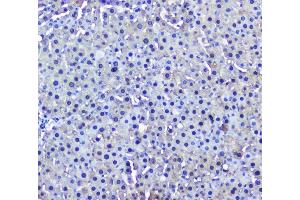 IHC analysis of GSTM1 using anti-GSTM1 antibody (ABIN5693233).