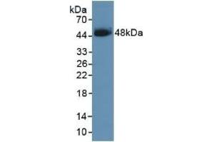 Detection of Recombinant SCCA1, Human using Polyclonal Antibody to Serpin B3 (SERPINB3) (SERPINB3 Antikörper  (AA 1-210))