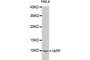 Western Blotting (WB) image for anti-Islet Amyloid Polypeptide (IAPP) antibody (ABIN1873117) (Amylin/DAP Antikörper)