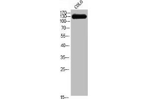 Western Blot analysis of COLO cells using CEP135 Polyclonal Antibody (CEP135 Antikörper  (C-Term))