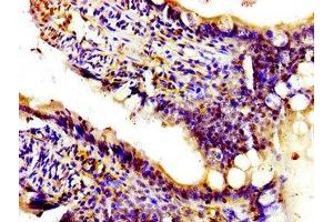 Immunohistochemistry of paraffin-embedded human small intestine tissue using ABIN7163188 at dilution of 1:100 (PIK3CA Antikörper  (Catalytic Subunit alpha))
