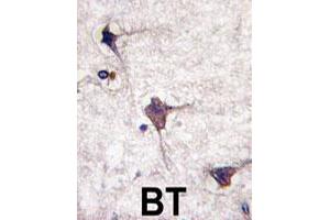 Formalin-fixed and paraffin-embedded human brain tissue reacted with PTPRR polyclonal antibody  , which was peroxidase-conjugated to the secondary antibody, followed by DAB staining.