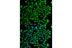 Immunofluorescence analysis of A549 cell using ZFYVE1 antibody. (ZFYVE1 Antikörper)