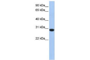 Western Blotting (WB) image for anti-Ankyrin Repeat and SOCS Box-Containing 12 (ASB12) antibody (ABIN2459538) (ASB12 Antikörper)