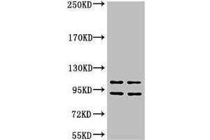 Western blot analysis of 1) Hela, 2) HepG2, diluted at 1:2000 (IDE Antikörper)