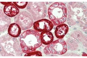 Detection of NOX4 in Human Kidney Tissue using Polyclonal Antibody to NADPH Oxidase 4 (NOX4) (NADPH Oxidase 4 Antikörper  (AA 220-392))