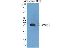 Western blot analysis of the recombinant protein. (UMPS Antikörper  (AA 311-481))