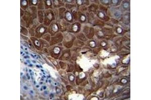 Immunohistochemistry (IHC) image for anti-Matrix Metallopeptidase 1 (Interstitial Collagenase) (MMP1) (AA 317-347) antibody (ABIN3031709)