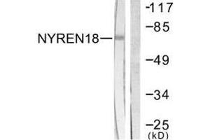 Western blot analysis of extracts from COS7 cells, using NYREN18 antibody. (NUB1 Antikörper  (C-Term))
