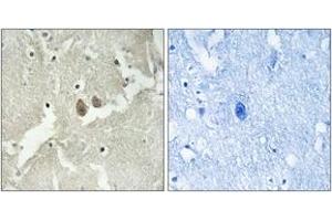 Immunohistochemistry analysis of paraffin-embedded human brain tissue, using NSG2 Antibody. (NSG2 Antikörper  (AA 33-82))