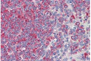Human Spleen (formalin-fixed, paraffin-embedded) stained with CD34 antibody ABIN337152 at 10 ug/ml followed by biotinylated secondary antibody, alkaline phosphatase-streptavidin and chromogen. (CD34 Antikörper)